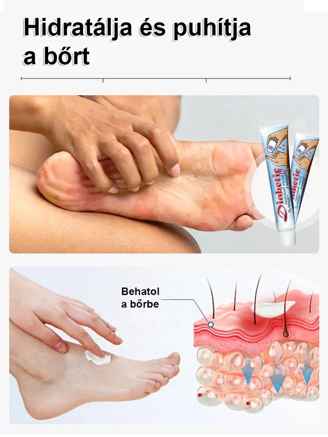 Sumifun vércukorszint kiegyensúlyozó krém