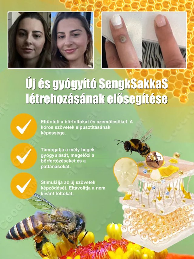 Testápoló szemölcs eltávolító megoldás