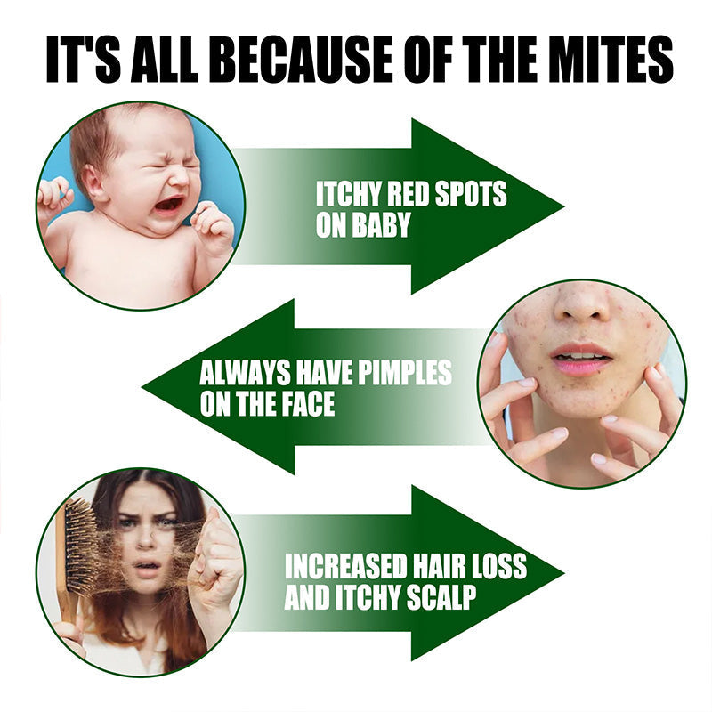 ⚡Korlátozott ideig kapható! Vásároljon 2-t, kap 1-et ingyen⚡-🧑‍⚕️Erős poratka-eltávolító spray