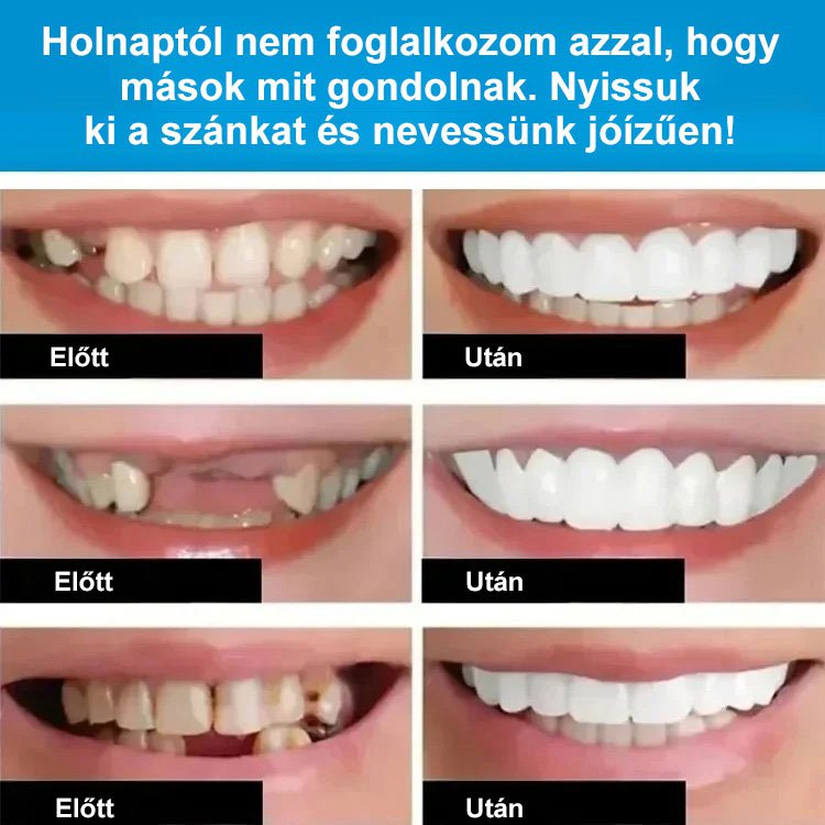 Tökéletes Mosoly Fogpótlás Készlet
