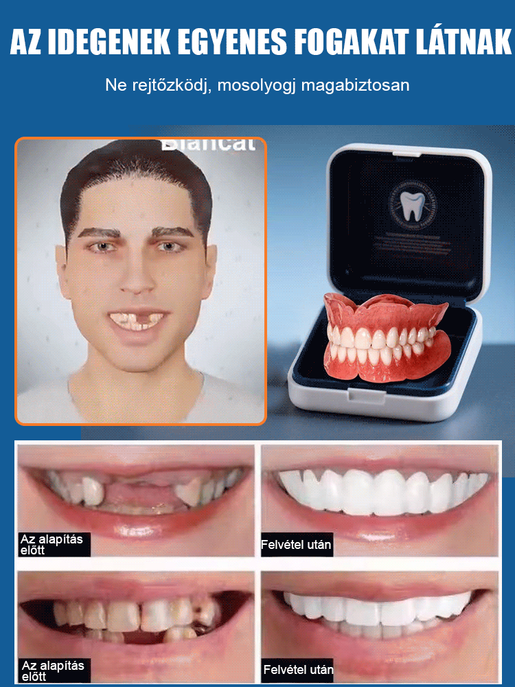 [Új brit kutatási eredmények] Szilikon szimulációs fogszabályozó fogszabályozó