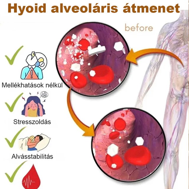 150 g nassolnivaló makadámdió
