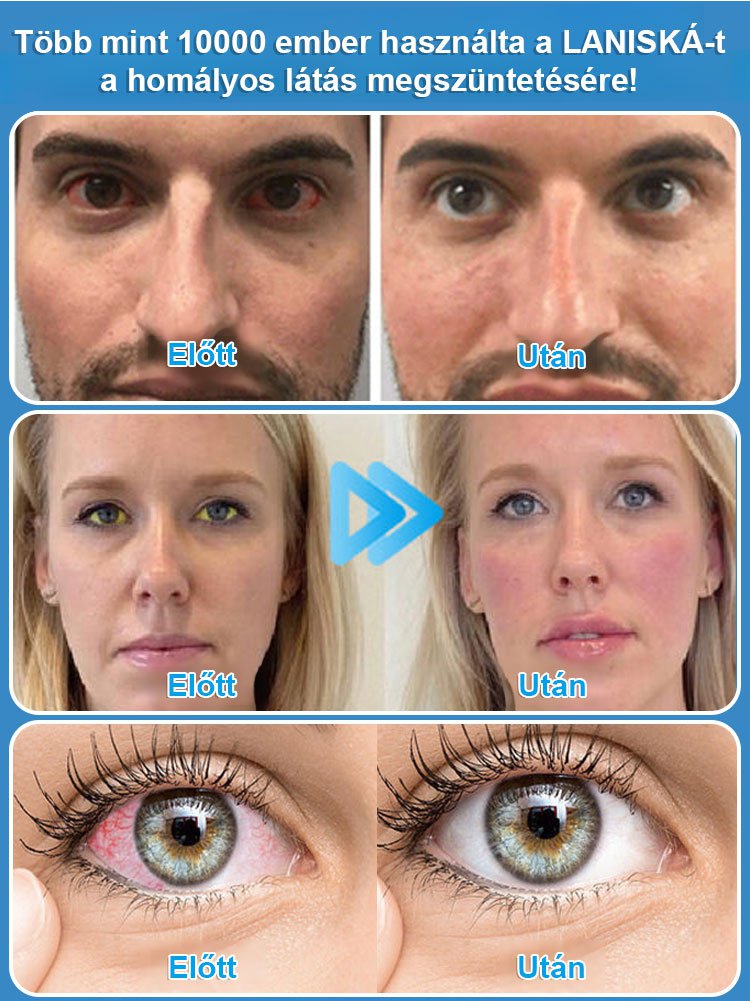 Látásjavító Szemcsepp-Nincs szükség műtétre a látás helyreállításához!