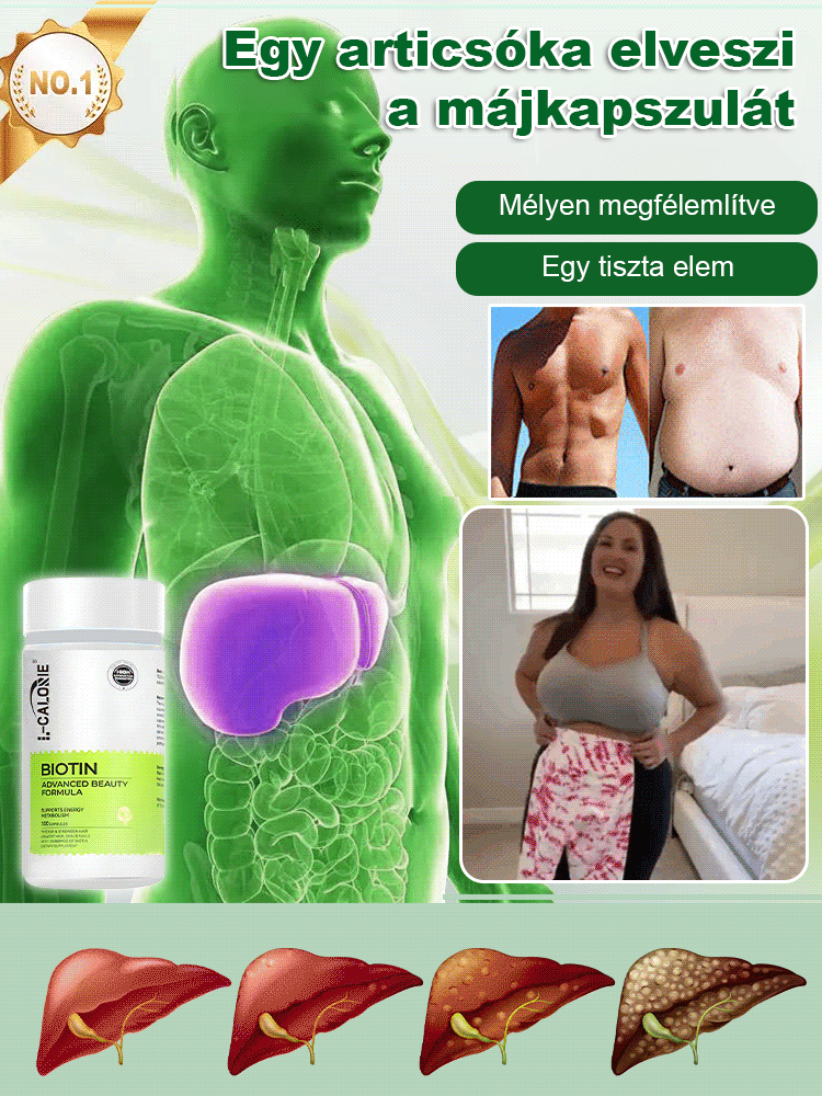 Víz Repülő Thistle kivonat májvédő kapszula