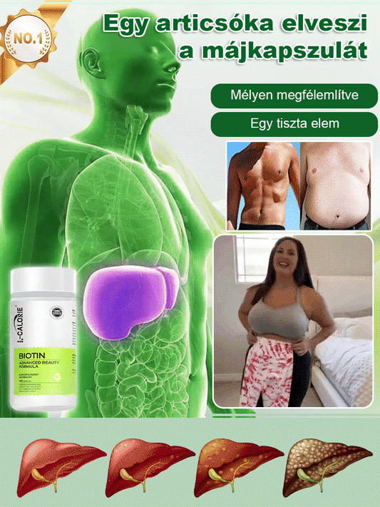 Víz Repülő Thistle kivonat májvédő kapszula