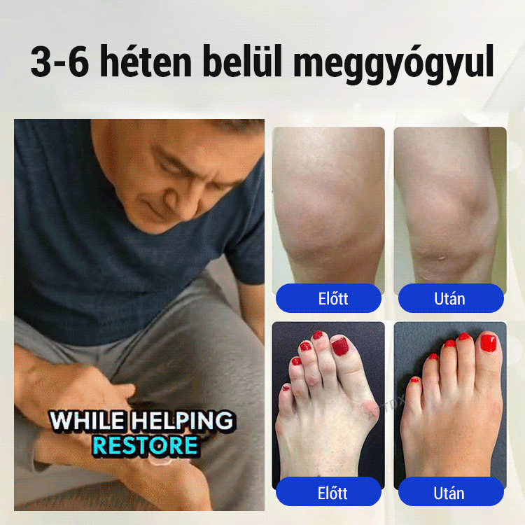 Lábidegápoló krém