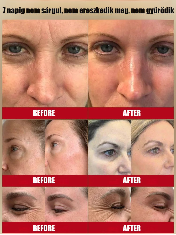 Öregedésgátló polipeptid ránctalanító arckrém