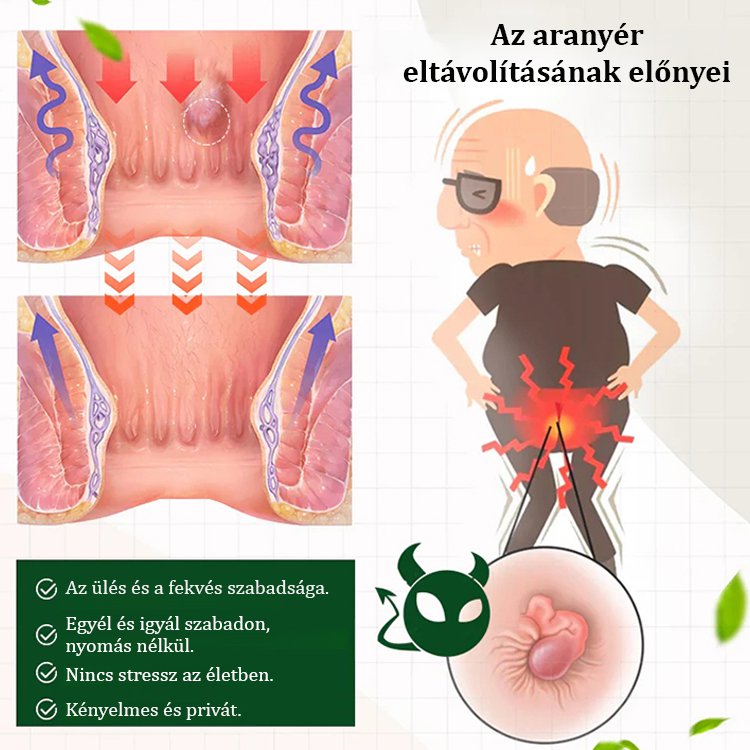 【Orvosi minőségű, 3 napos aranyér elleni kezelés】Fájdalommentes anális ápoló spray