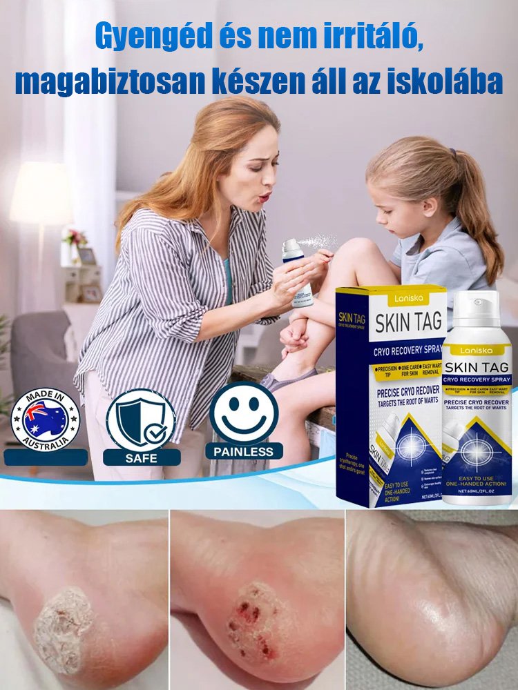 LANISKA szemölcs elleni külső ápoló spray