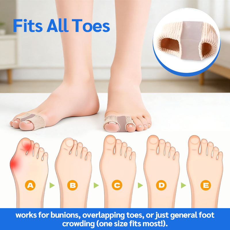 Lábujjszétválasztó és hallux valgus korrekció🦶